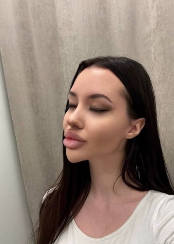 Лисса, Г. Бодайбо